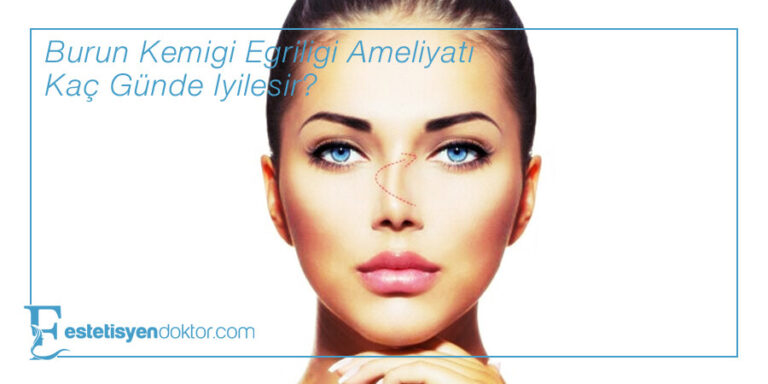 Burun Kemiği Eğriliği Ameliyatı Kaç Günde İyileşir?