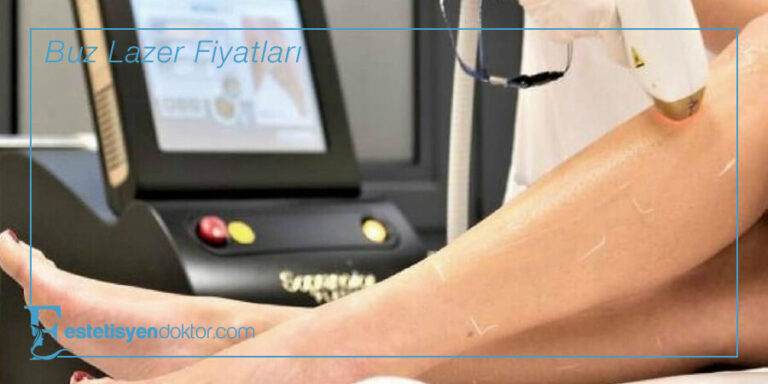 Buz Lazer Fiyatları – 2023
