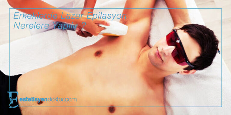 Erkeklerde Lazer Epilasyon Nerelere Yapılır?
