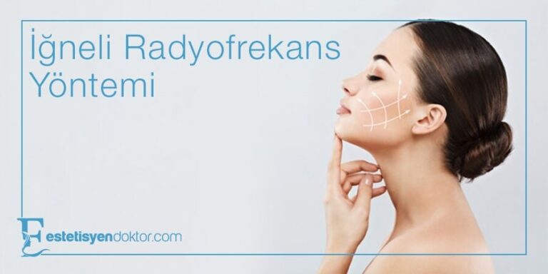 İğneli Radyofrekans Nedir?