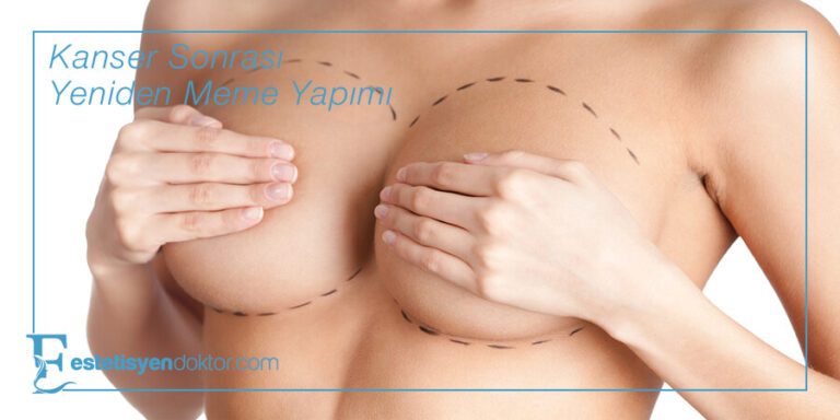 Kanser Sonrası Yeniden Meme Yapımı