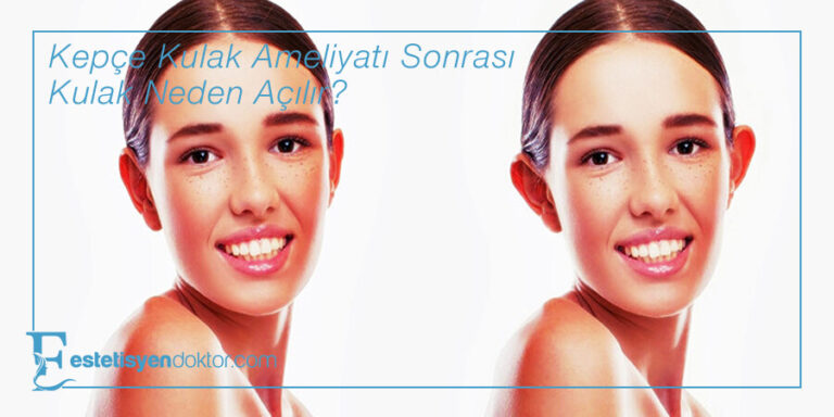 Kepçe Kulak Ameliyatından Sonra Açılma