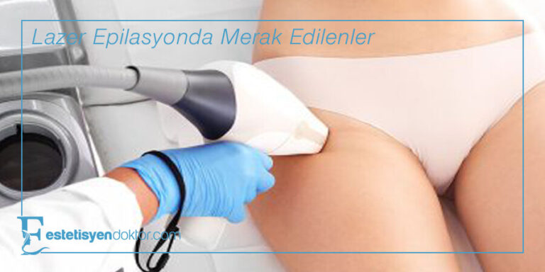 Lazer Epilasyonda Merak Edilenler – 2023