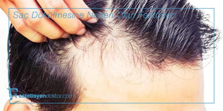 Saç Dökülmesine Neden Olan Faktörler