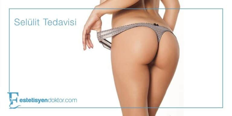 Selülit Tedavisinde En Etkili Yöntem Nedir