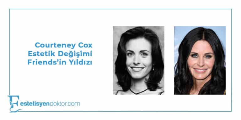 Courteney Cox Estetik Değişimi Friends Yıldızı