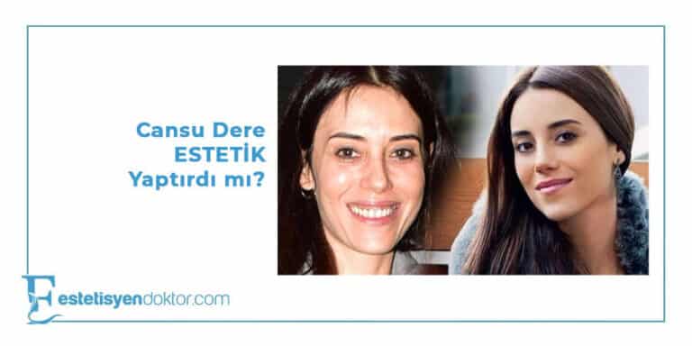 Cansu Dere Estetik Yaptırdı Mı?