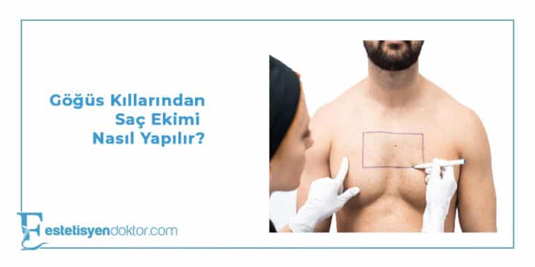 Göğüs Kıllarından Saç Ekimi Nasıl Yapılır?