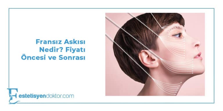 Fransız Askısı Nedir? Fiyat ve Detayları