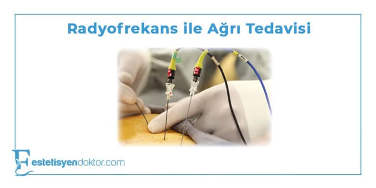 Radyofrekans ile Ağrı Tedavisi