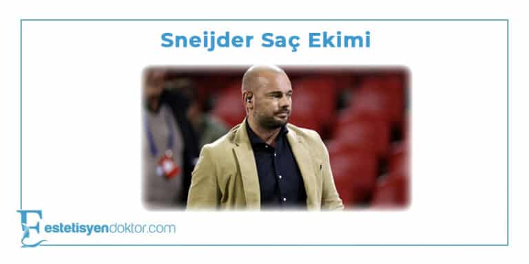 Sneijder Saç Ekimi