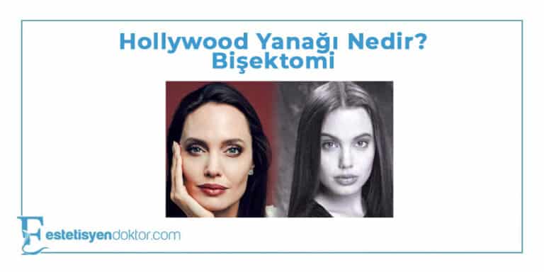 Hollywood Yanağı Nedir? – Bişektomi