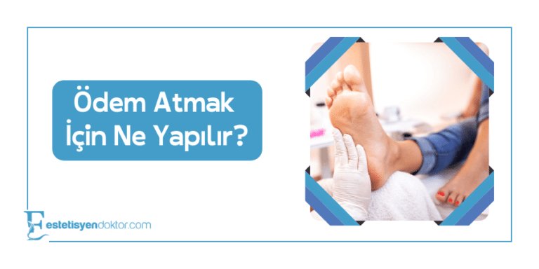Ödem Atmak İçin Ne Yapılır?