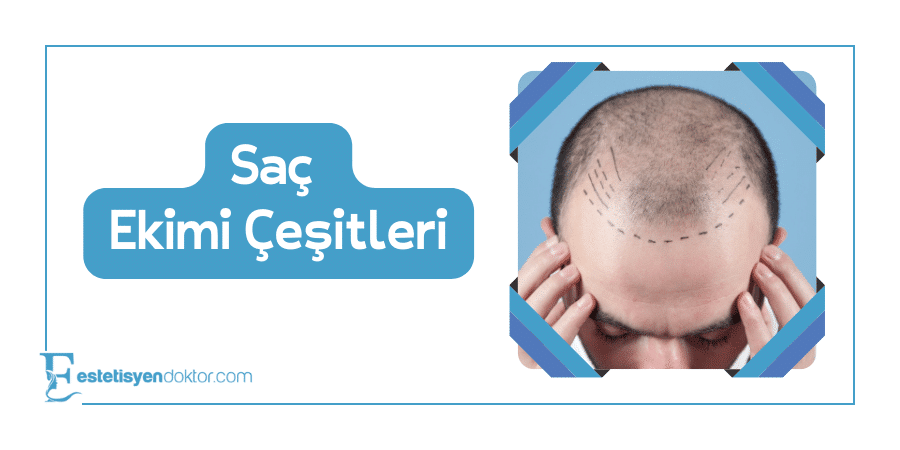 Saç Ekimi Çeşitleri - Estetisyen Doktor